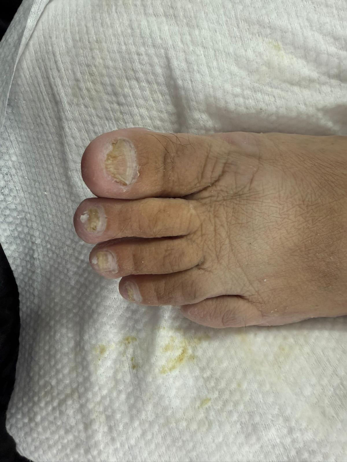 פדיקור רפואי